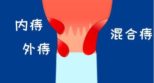 黹˳̴ţ